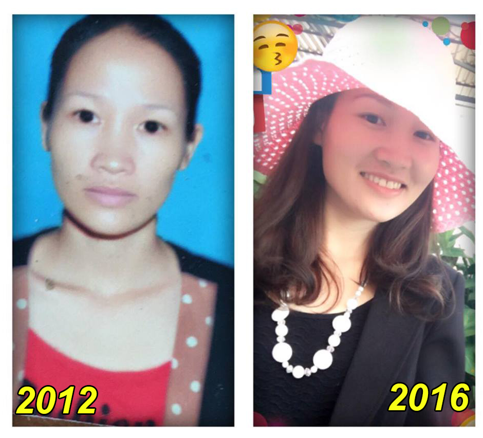 Tôi tên Nguyễn Thị Tươi, năm nay tôi 32 tuổi. Sống ở Bình Dương – Việt Nam.